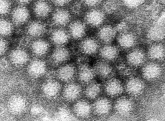 Norovirus Outburst: Understanding the Surge of Stomach Bug Outbreaks