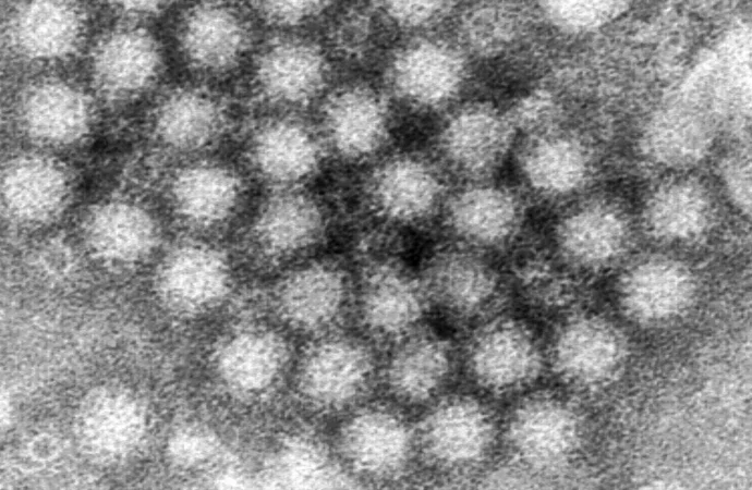 Norovirus Outburst: Understanding the Surge of Stomach Bug Outbreaks