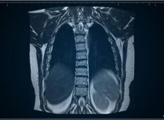 Understanding Long COVID in Children: A New Window into Lung Health