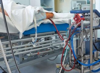 Understanding ECMO: A Lifeline for Critically Ill Patients