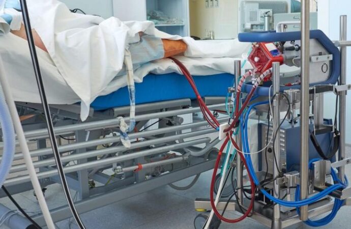 Understanding ECMO: A Lifeline for Critically Ill Patients