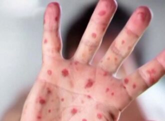 Understanding the Differences: Rubella vs. Measles and the Importance of Vaccination