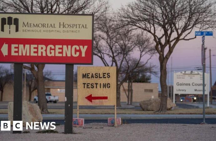 The Resurgence of Measles: A Call for Vigilance and Vaccination