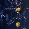 Unveiling the Mysteries of Microglia: Hope for Alzheimer’s Disease