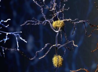 Unveiling the Mysteries of Microglia: Hope for Alzheimer’s Disease