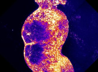 A New Frontier in Pain Research: Recreating the Brain’s Pain Pathway in a Dish