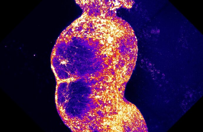 A New Frontier in Pain Research: Recreating the Brain’s Pain Pathway in a Dish