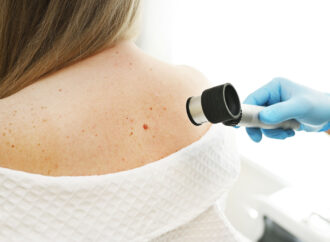 Protecting Your Skin: A Guide to Preventing Melanoma