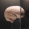 Nanoparticles: The Key to Unlocking the Brain’s Defenses?